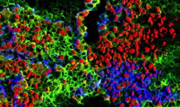 Como o Ferro pode Remover o Arsênico da Água