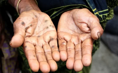 A contaminação de alimentos e água por arsênico é uma preocupação global de saúde pública, os pesquisadores estudam como isso causa câncer