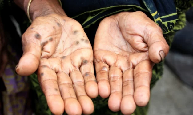 A contaminação de alimentos e água por arsênico é uma preocupação global de saúde pública, os pesquisadores estudam como isso causa câncer